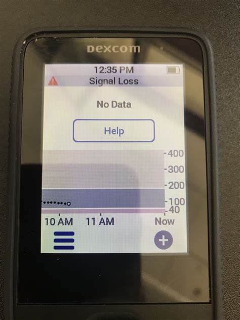Signal Loss on Dexcom G6