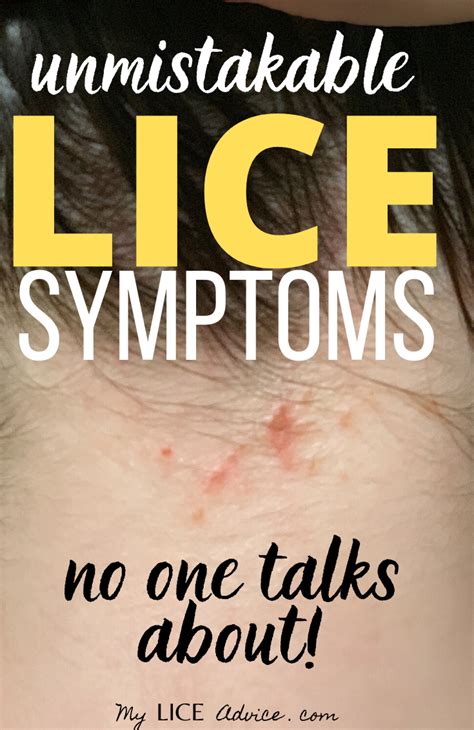 Signs You Might Have Lice