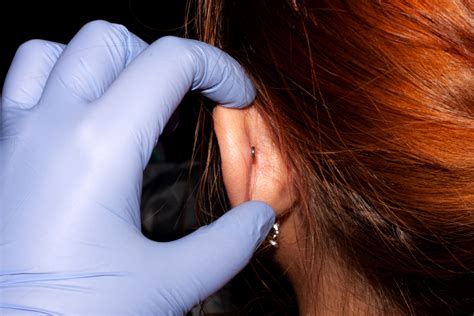 Signs of Healed Piercings