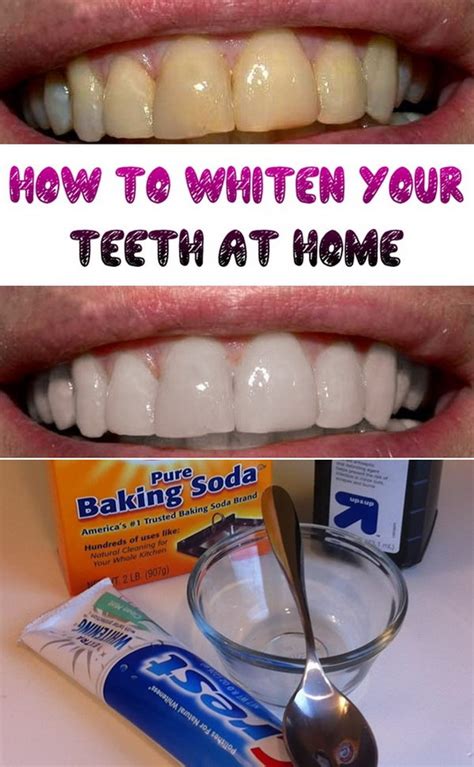 Simple Home Remedies for Teeth Whitening