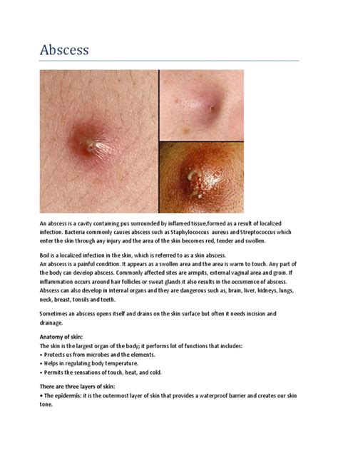 Unveiling the Mystery: A Visual Journey through Skin Abscesses - Dive into the Medical Images Here!