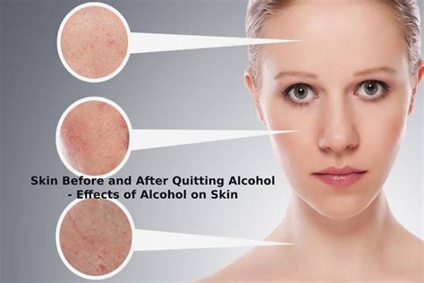Regaining Your Youthful Glow: The Remarkable Transformation of Your Skin After Quitting Drinking