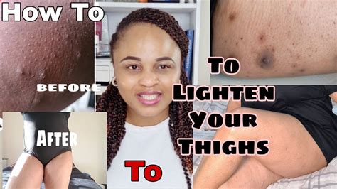 Lighten and Brighten Your Inner Thighs: The Ultimate Guide to Safe and Effective Skin Bleaching Methods