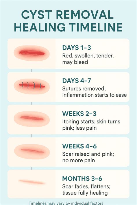 Radiate with Confidence: Unveiling the Swift Skin Bridge Removal Recovery Time!