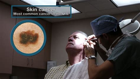 Protect your Skin and Loved Ones: Find the Closest Skin Cancer Clinic Today