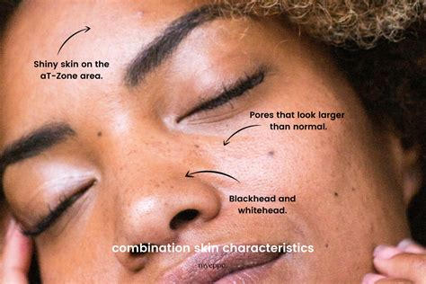The Art and Science of Skin Color: Understanding the Delicate Balance Between Genetics and Environment