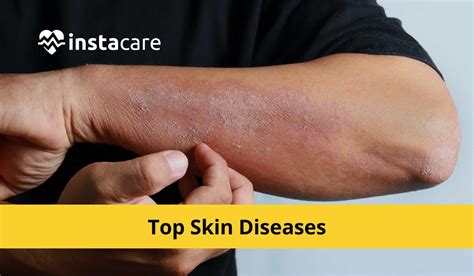 Skin Diseases & Treatments: See a Specialist.