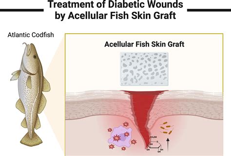 Revolutionary Rejuvenation: Exploring the Pioneering Technique of Skin Grafting with Fish Skin