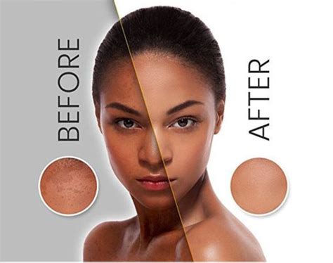 Illuminate Your Skin: Discover The Top Skin Lighteners For Beautiful Black Skin