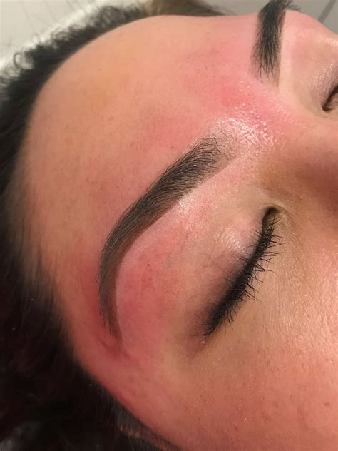 Tips for dealing with skin ripped off from waxing