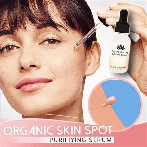Unveiling Flawless Skin Perfection: Unleash the Benefits of Skin Spot Purifying Serum