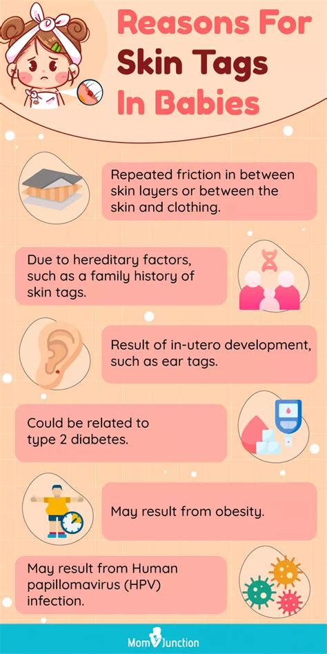 Unraveling the Mystery of Skin Tags on Babies