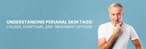 Removing Skin Tags from Perianal Area - A Comprehensive Guide