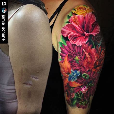 Skin Tone Tattoo Cover Up