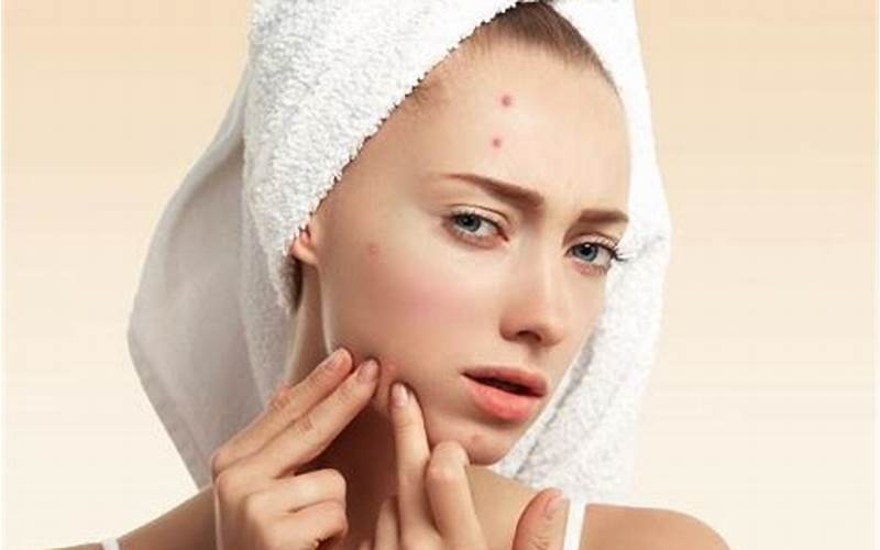 Skincare Jerawat Ampuh, Tips Dan Rahasia Agar Kulit Bebas Jerawat