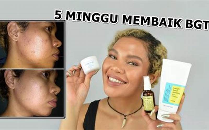 Skincare Untuk Menghilangkan Bekas Jerawat Dan Komedo