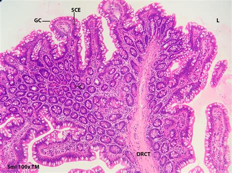 Digestive System, Part 7 The Ileum Tissue biology