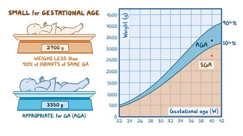 Small For Gestational Age Chart