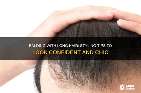 Smart Styling Tips for Balding Hair