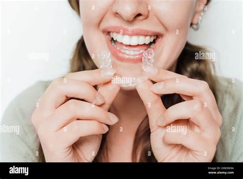 Smiling Woman With Clear Aligners