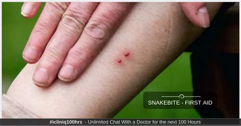 Snakebite Diet