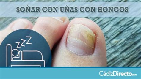 Cómo identificar si tienes hongos en los pies | Olor de los pies