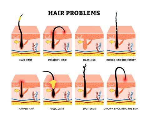 Solving Common Hair Concerns