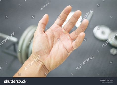 Sore Hands Weightlifting