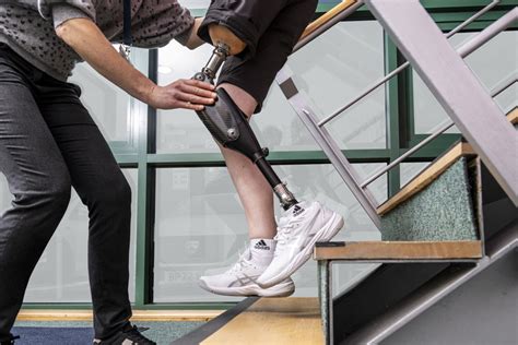 Specific Considerations for Prosthetic Wearers