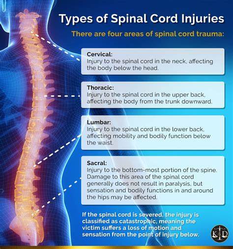 Spinal Cord Injuries after Car Accident