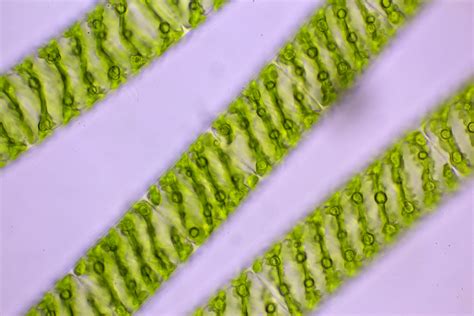 Spirogyra
