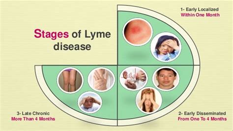Stage I Localized Disease