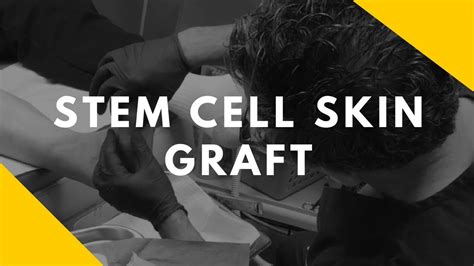 Stem Cell Skin