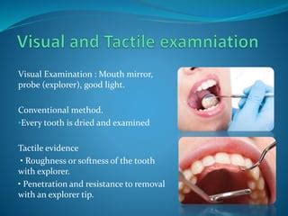 Step 1: Visual and Tactile Examination