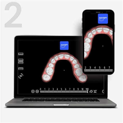 Step 2: Custom Treatment Plan