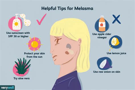 Step-by-Step Approach to Get Rid Melasma
