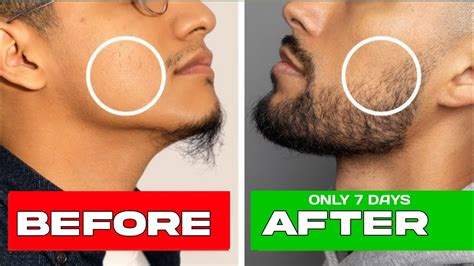 Step-by-Step Guide: Maximizing Results with Man Matters