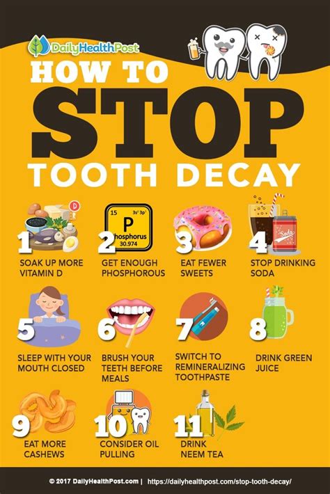 Stop Tooth Decay: 7 Simple Solutions