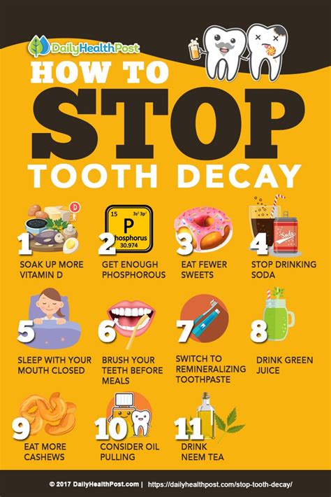 Stop Tooth Decay: Effective Methods Now!