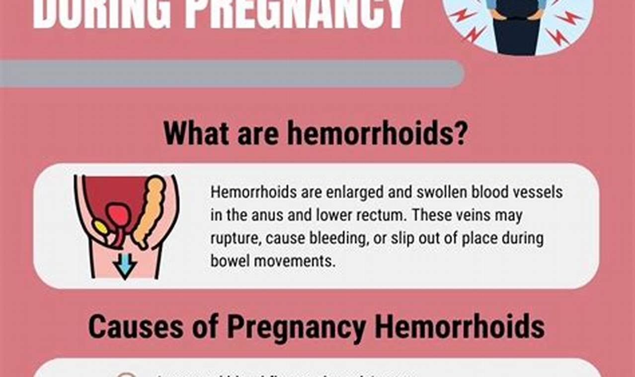 Strategies for constipation, hemorrhoids in pregnancy
