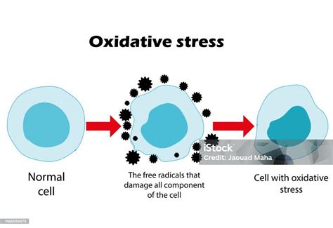 Stres Oksidatif