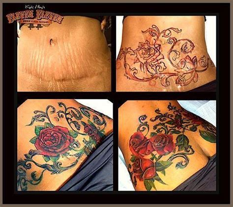 Stretch Mark Tattoo Cover Up