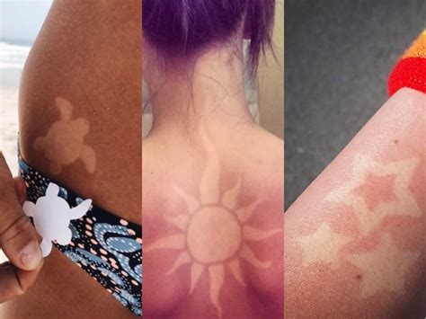 Sun Burn Tattoo