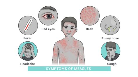 Sunken Measles