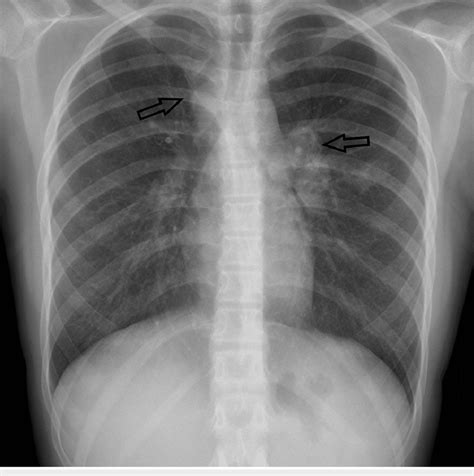 Superior Coverage and Opacity