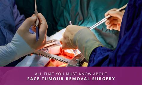 Surgery Direct Tumor Removal