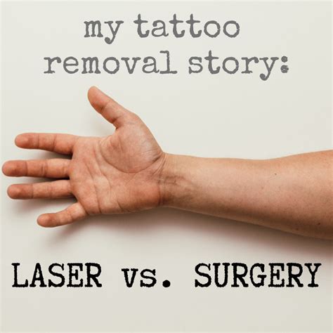 Surgical Tattoo Removal Tattoo And Scar Removal,how
