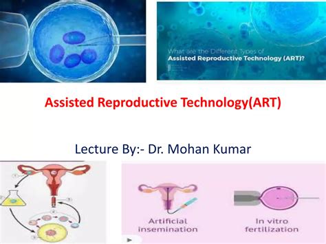Surgical Treatment vs. Assisted Reproductive Technology (ART)