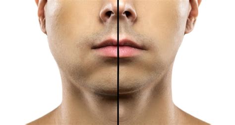 Swollen Cheeks: Causes & Fast Relief Tips
