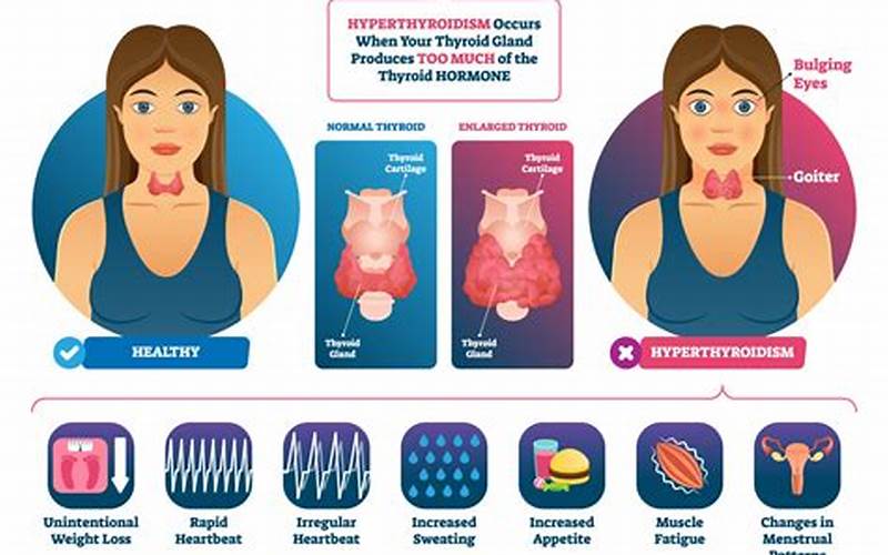 Symptoms Of Thyroid Disorders